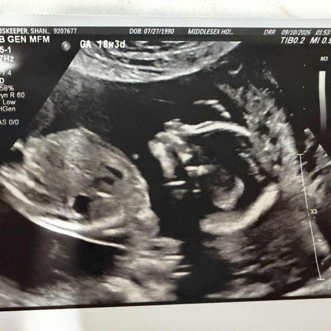 Photo shared by Shannon for their Babylist baby registry.