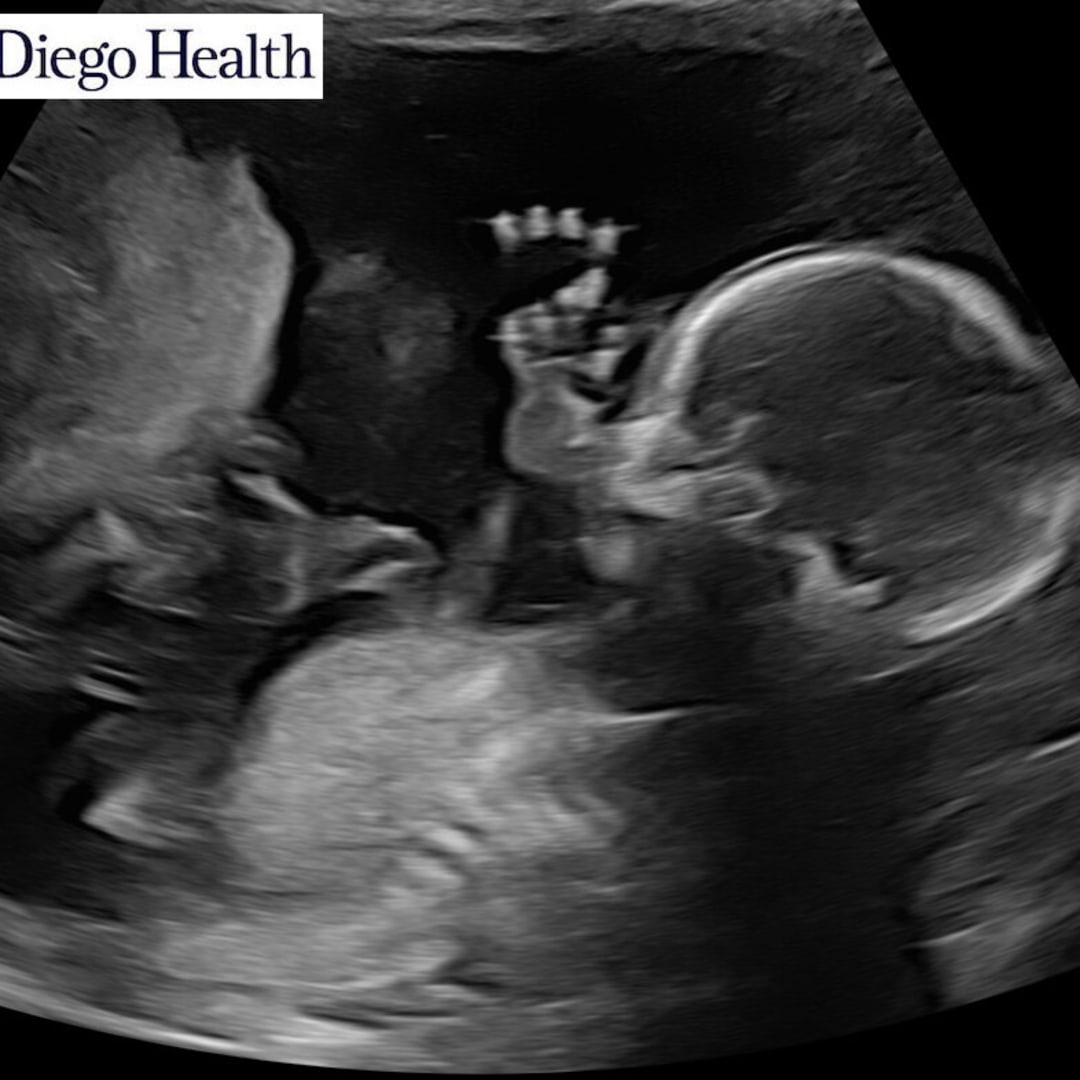 Photo shared by Fatima for their Babylist baby registry.