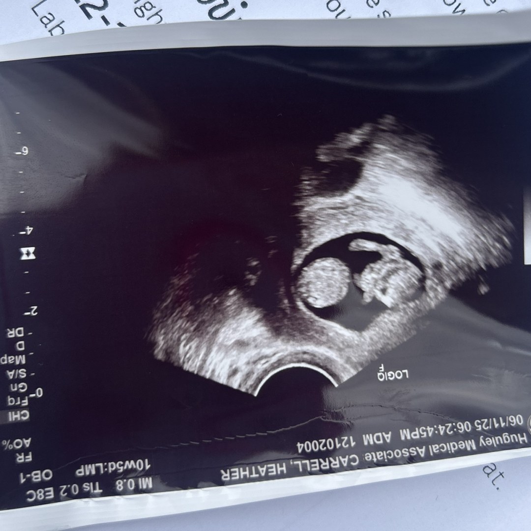 Photo shared by Heather for their Babylist baby registry.