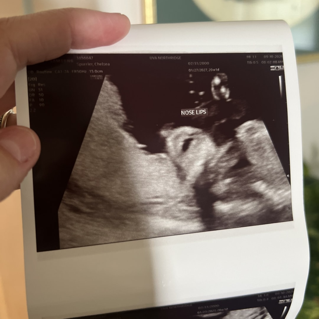 Photo shared by Chelsea for their Babylist baby registry.