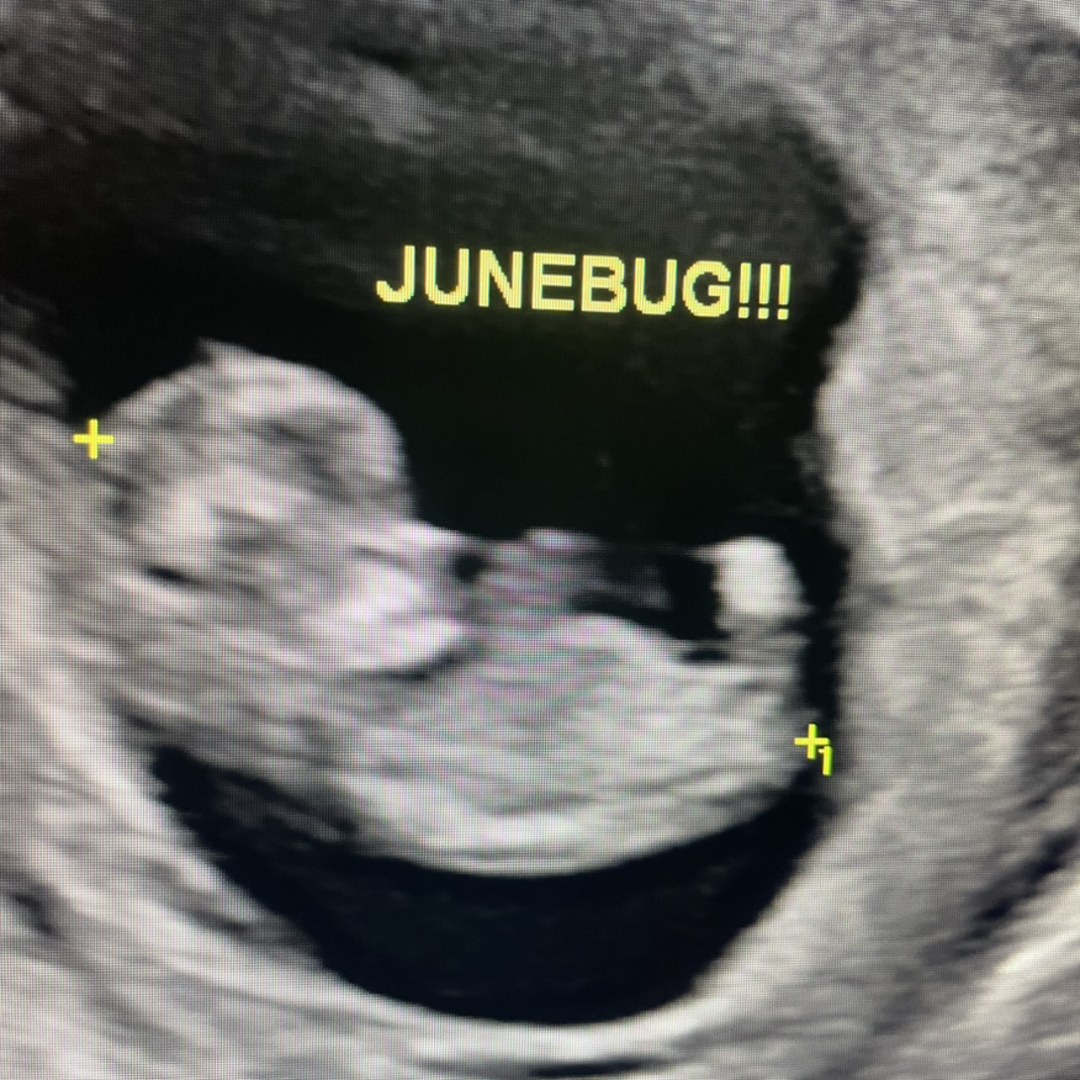 Photo shared by Crystal for their Babylist baby registry.