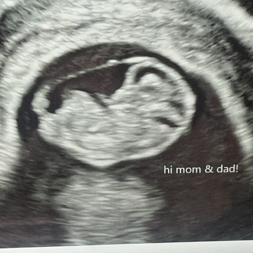 Photo shared by Emily for their Babylist baby registry.