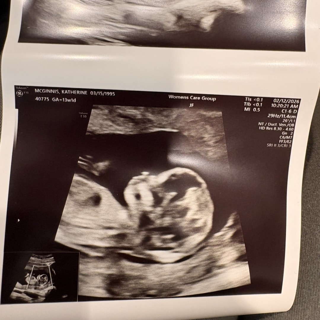 Photo shared by Kate for their Babylist baby registry.