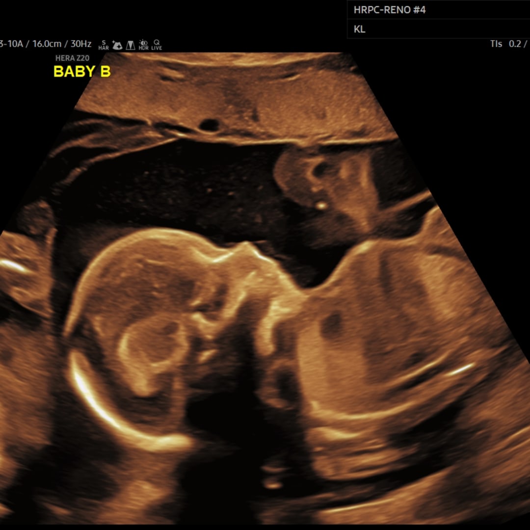 Photo shared by Linsey for their Babylist baby registry.