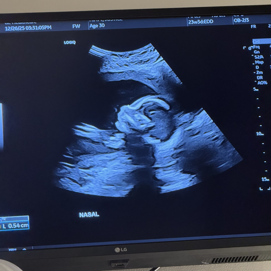 Photo shared by Justice for their Babylist baby registry.