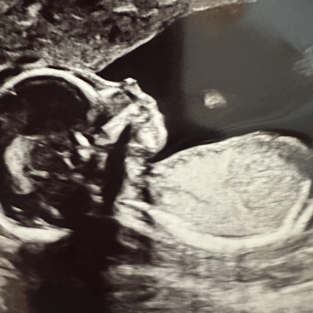 Photo shared by Kayla for their Babylist baby registry.