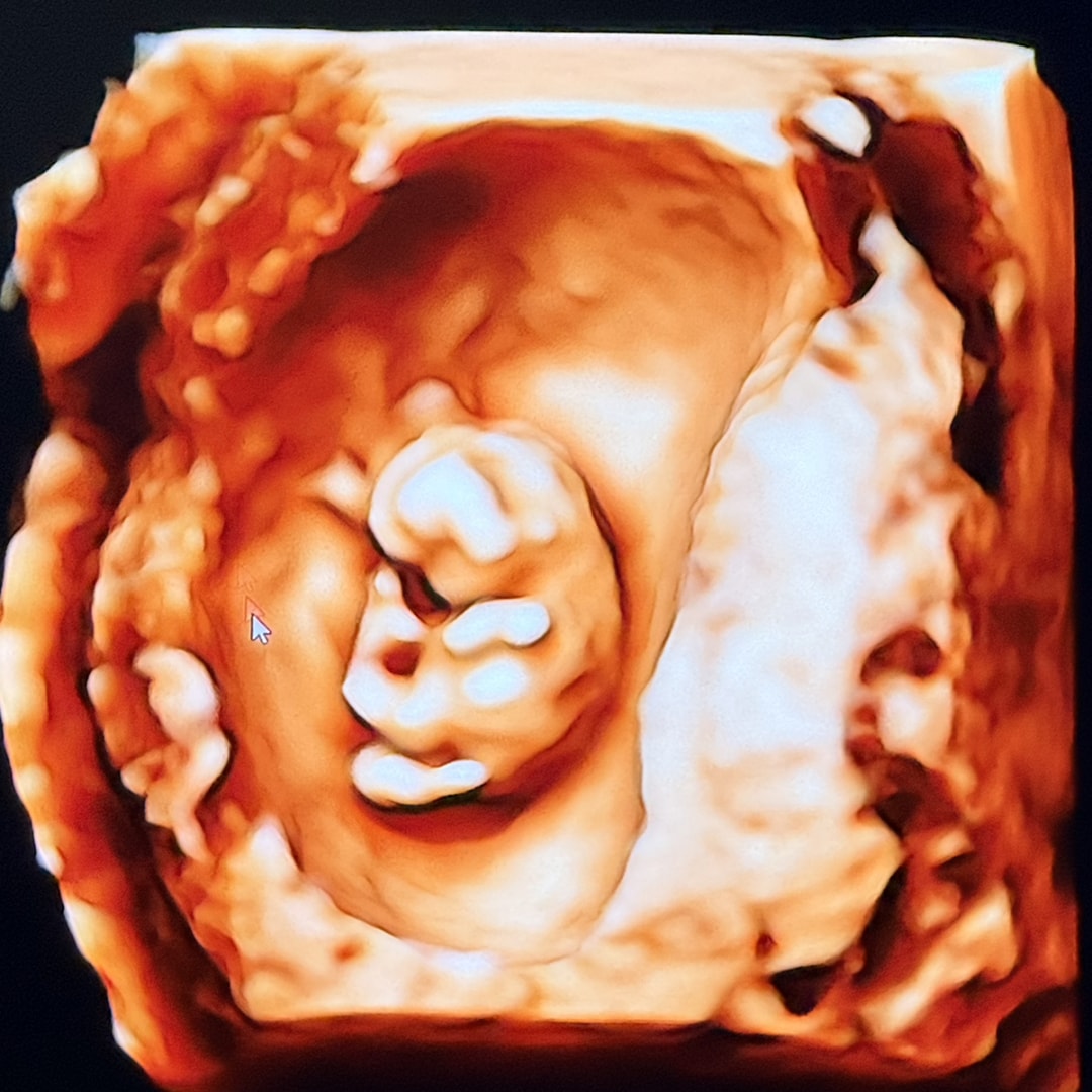 Photo shared by Anastassia for their Babylist baby registry.