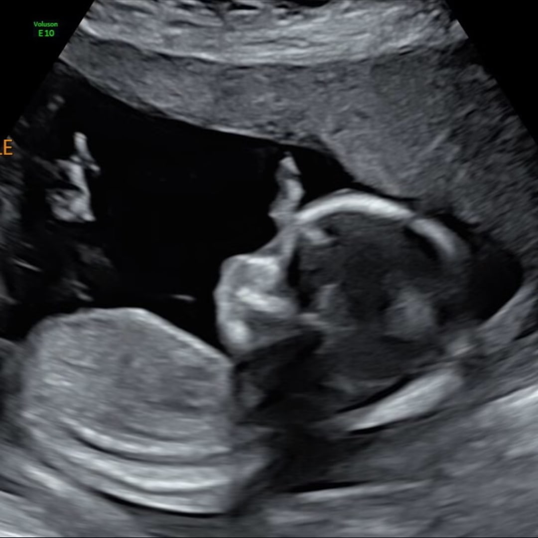 Photo shared by Jessica for their Babylist baby registry.