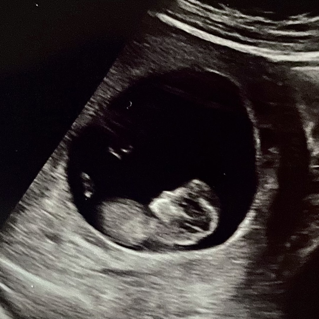 Photo shared by Jessica for their Babylist baby registry.