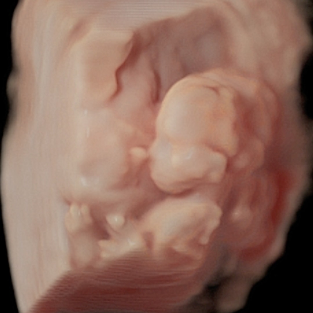 Photo shared by Emily for their Babylist baby registry.