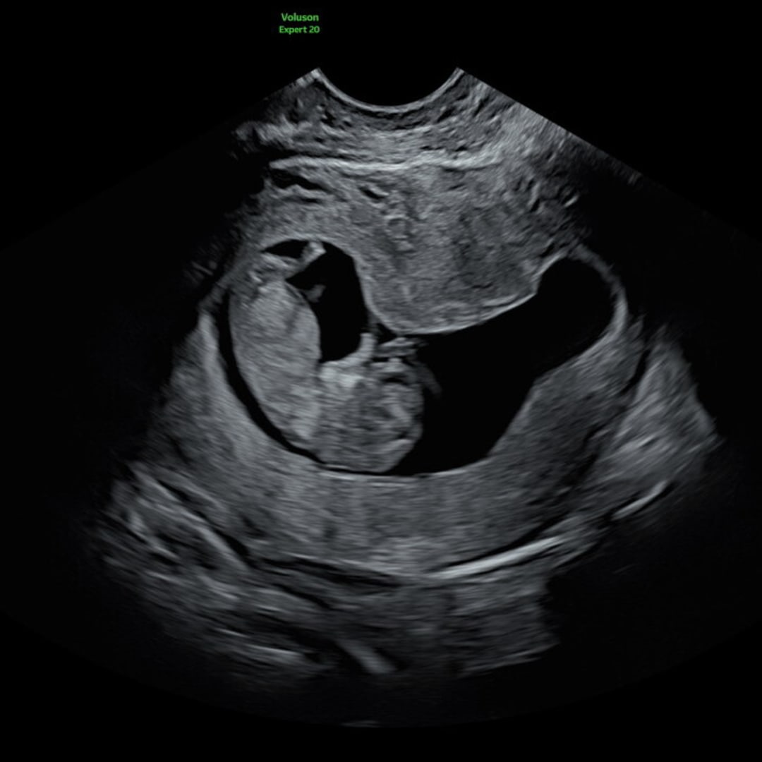 Photo shared by Bridget for their Babylist baby registry.
