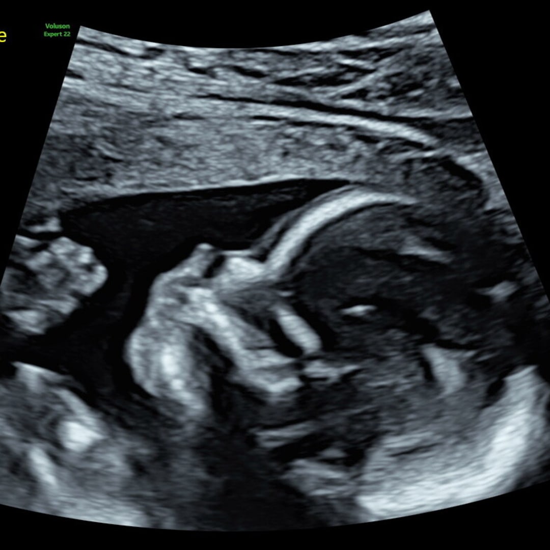 Photo shared by Jennifer for their Babylist baby registry.