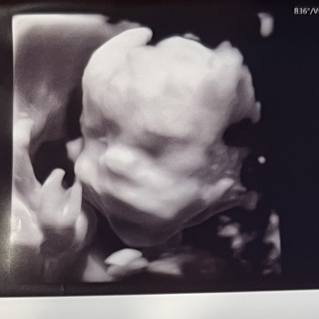 Photo shared by Haley for their Babylist baby registry.