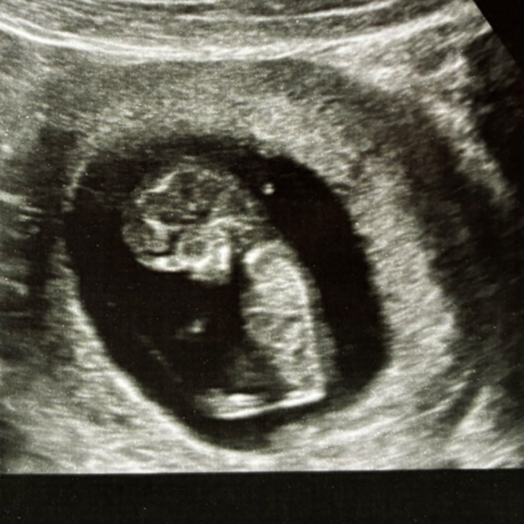 Photo shared by Abigail for their Babylist baby registry.