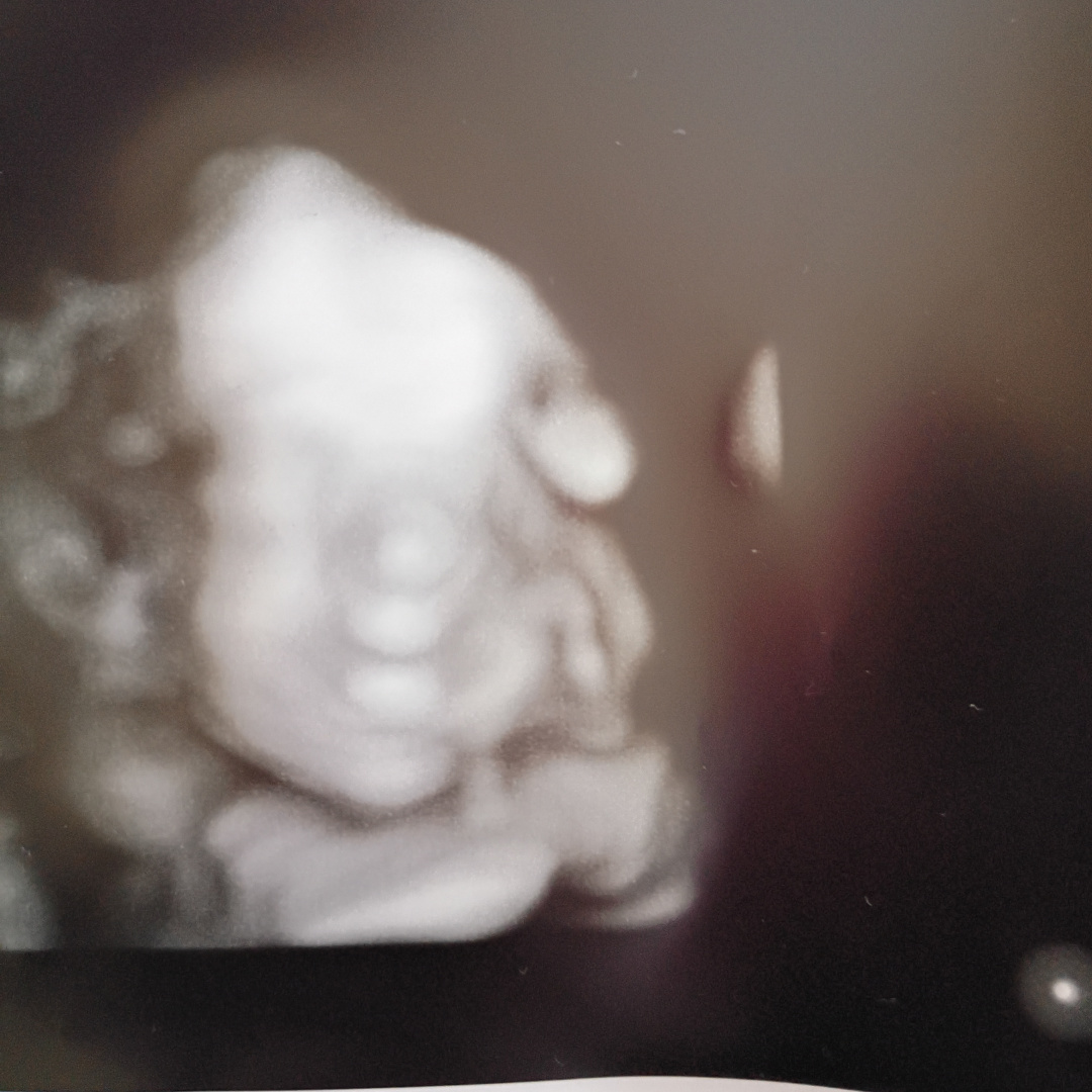 Photo shared by Kloee for their Babylist baby registry.