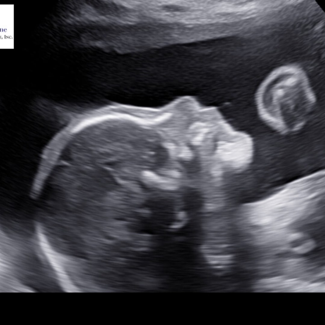 Photo shared by Christie for their Babylist baby registry.