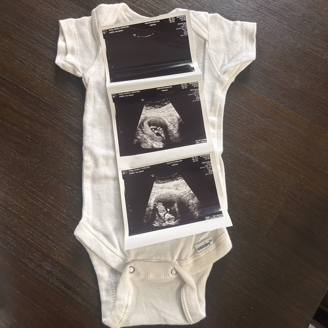 Photo shared by Heather for their Babylist baby registry.