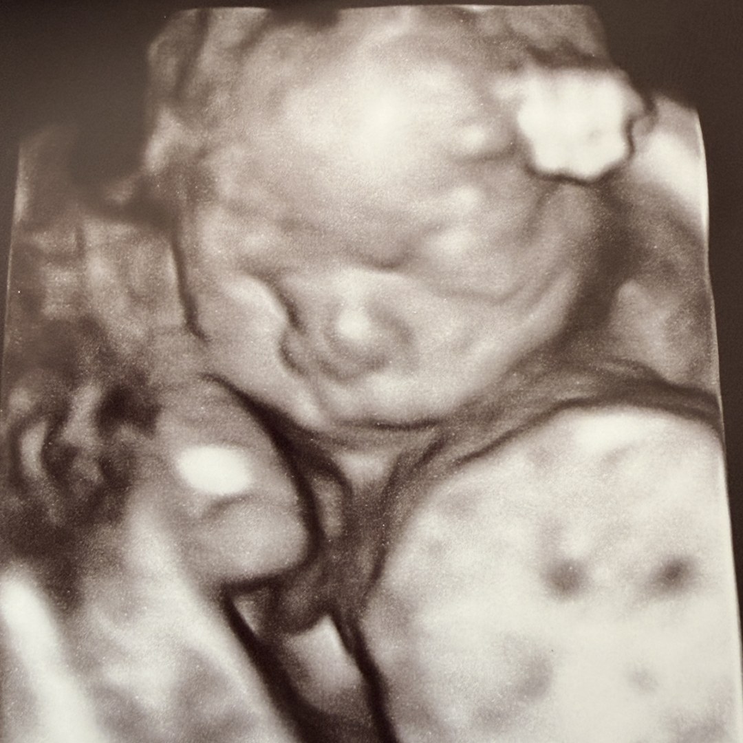 Photo shared by Jordan for their Babylist baby registry.