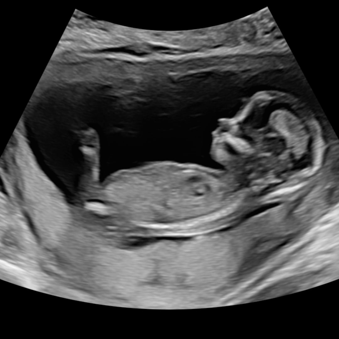 Photo shared by Danielle for their Babylist baby registry.