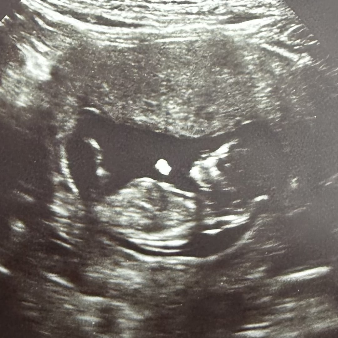 Photo shared by Alexandra for their Babylist baby registry.