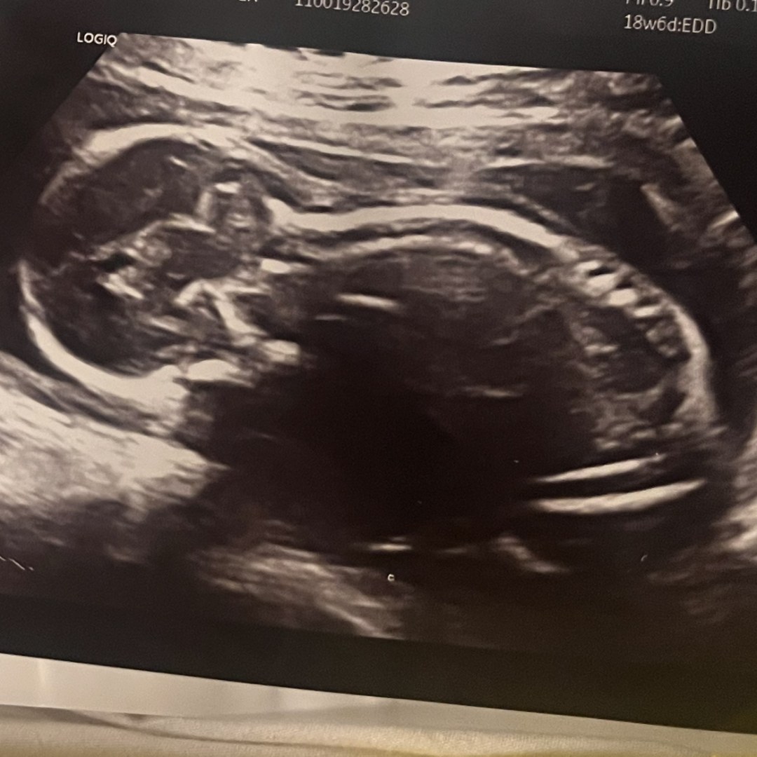 Photo shared by Isabel for their Babylist baby registry.
