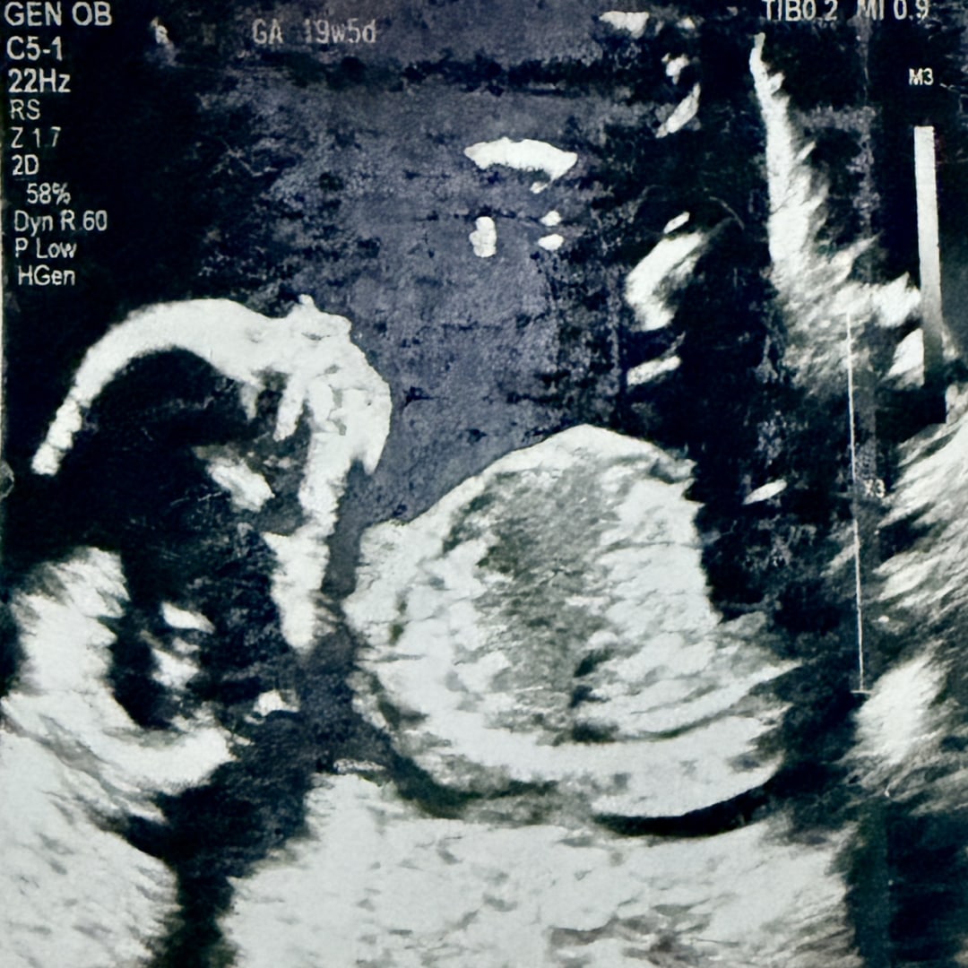 Photo shared by Maria Laura for their Babylist baby registry.