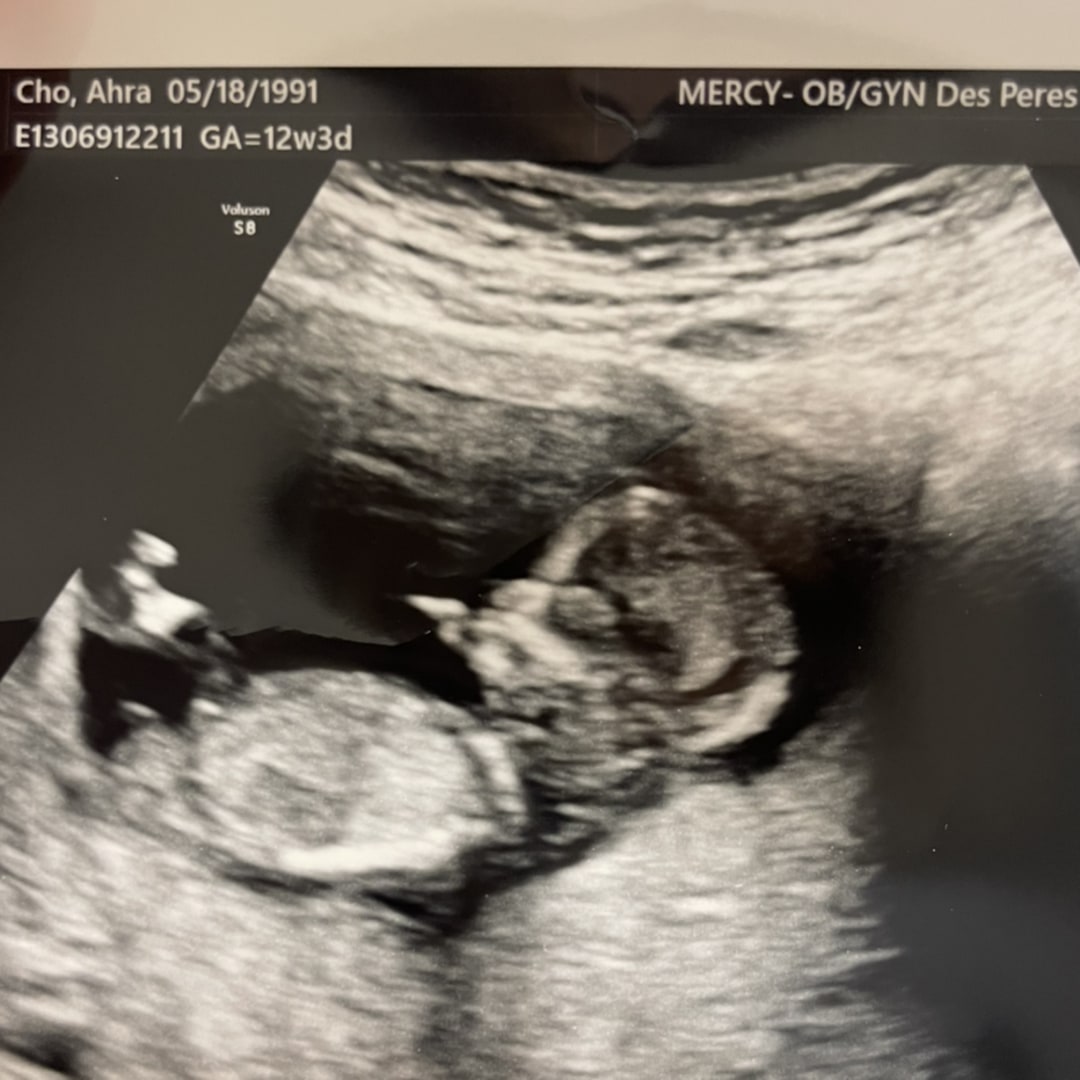 Photo shared by Ahra for their Babylist baby registry.