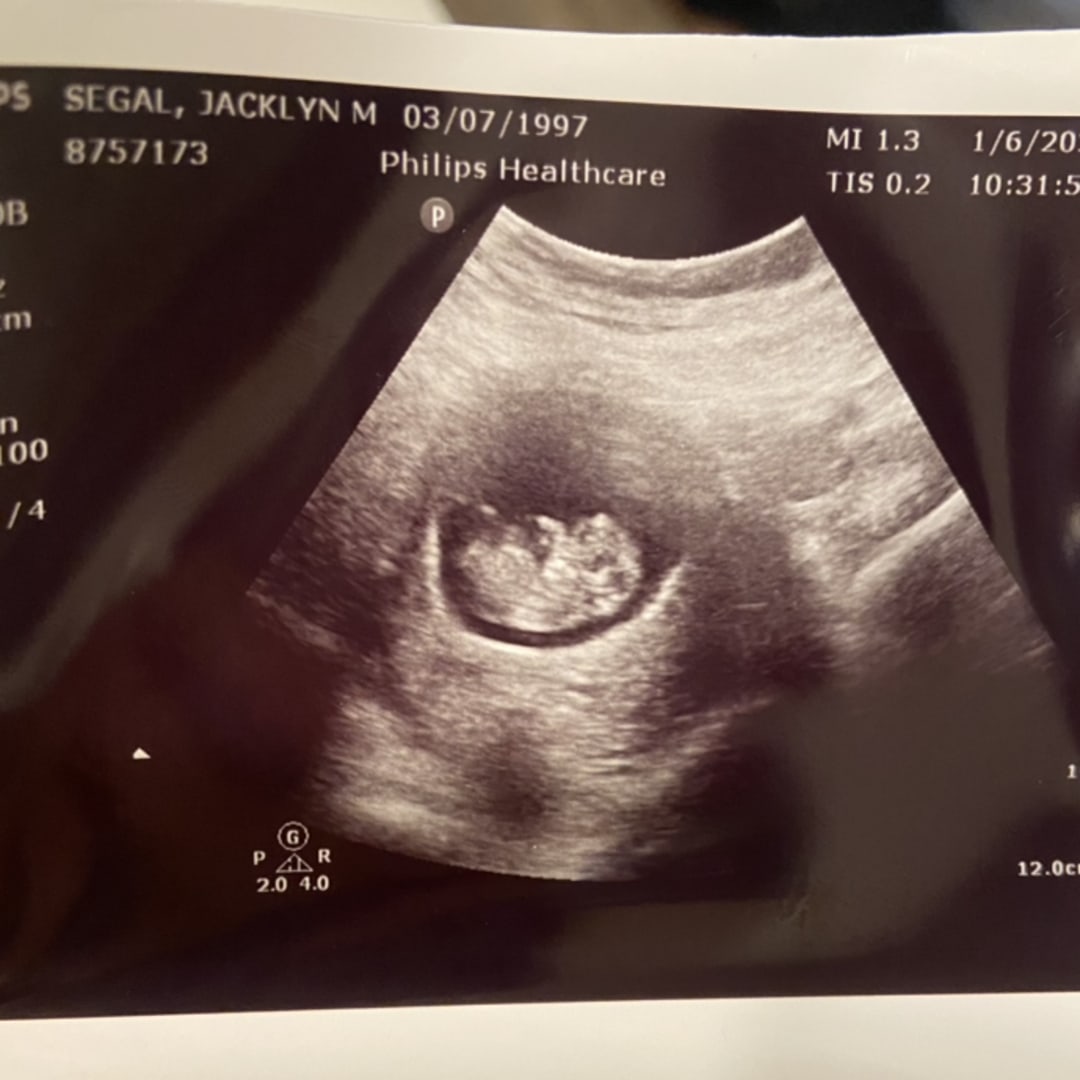 Photo shared by Jacki for their Babylist baby registry.