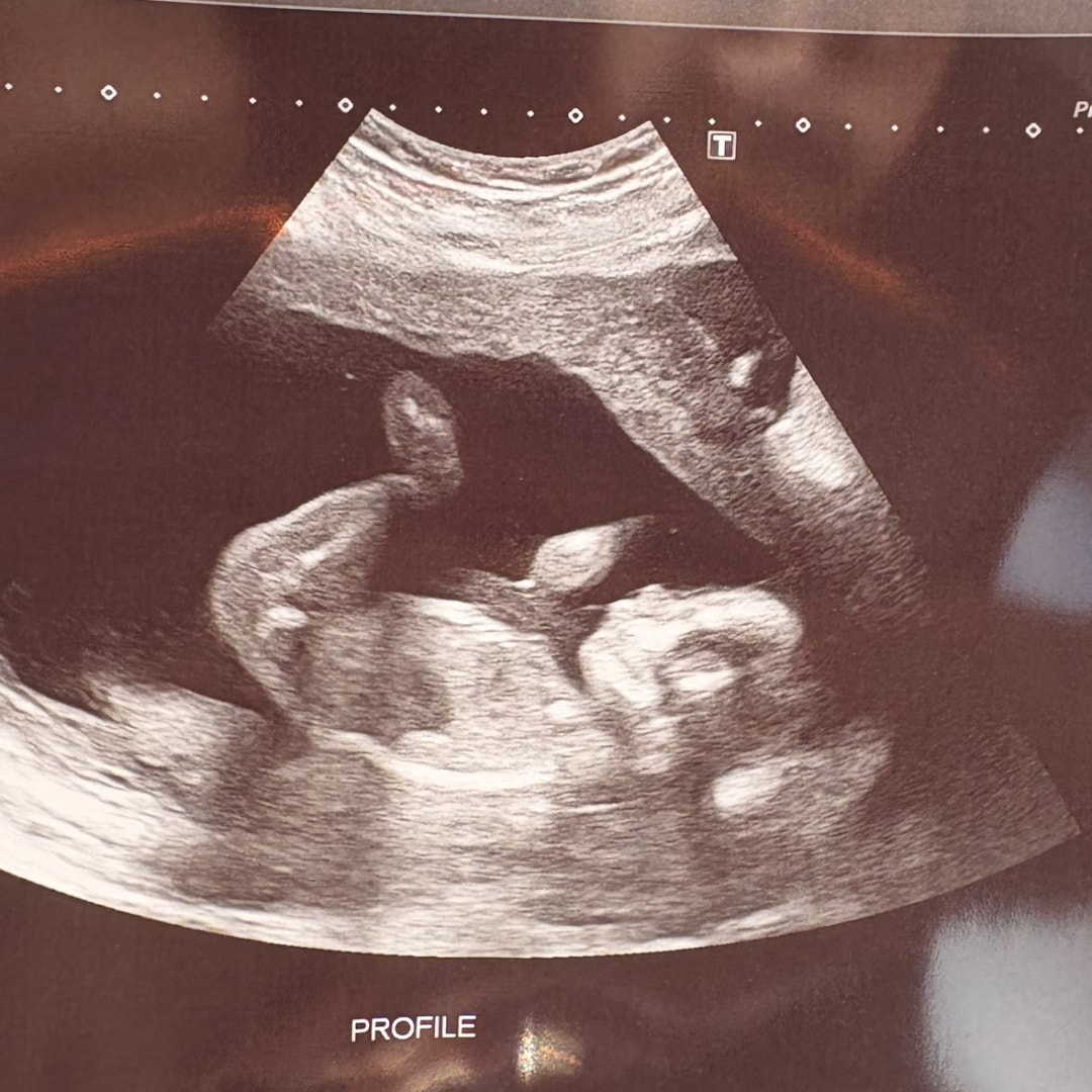 Photo shared by Lillyanna for their Babylist baby registry.