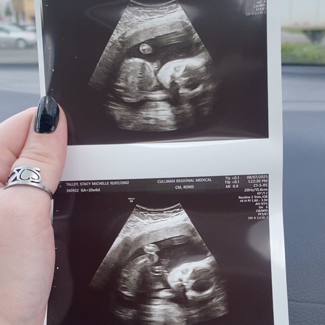 Photo shared by Stacy for their Babylist baby registry.