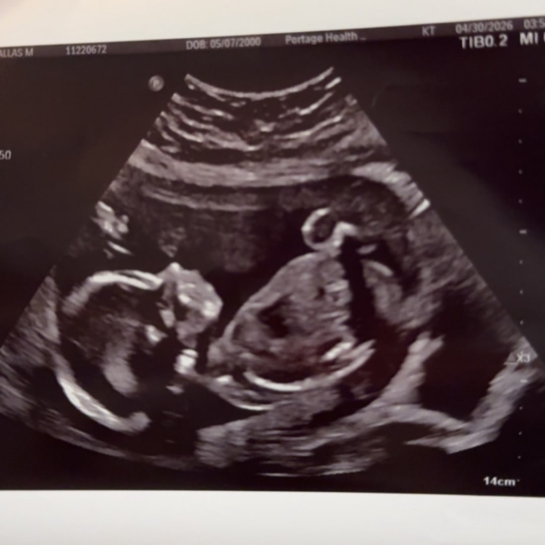 Photo shared by Dallas for their Babylist baby registry.