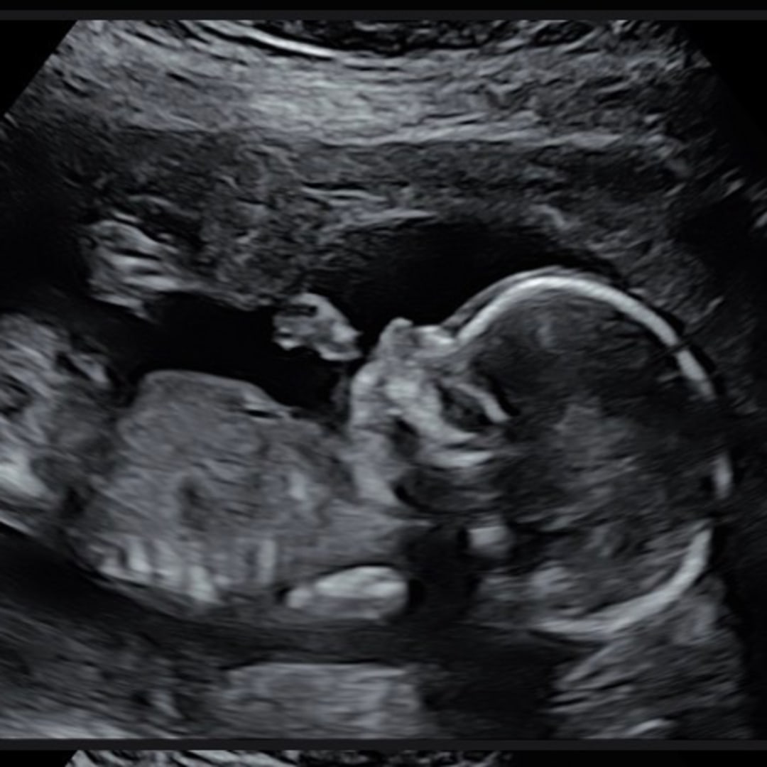 Photo shared by Sara for their Babylist baby registry.