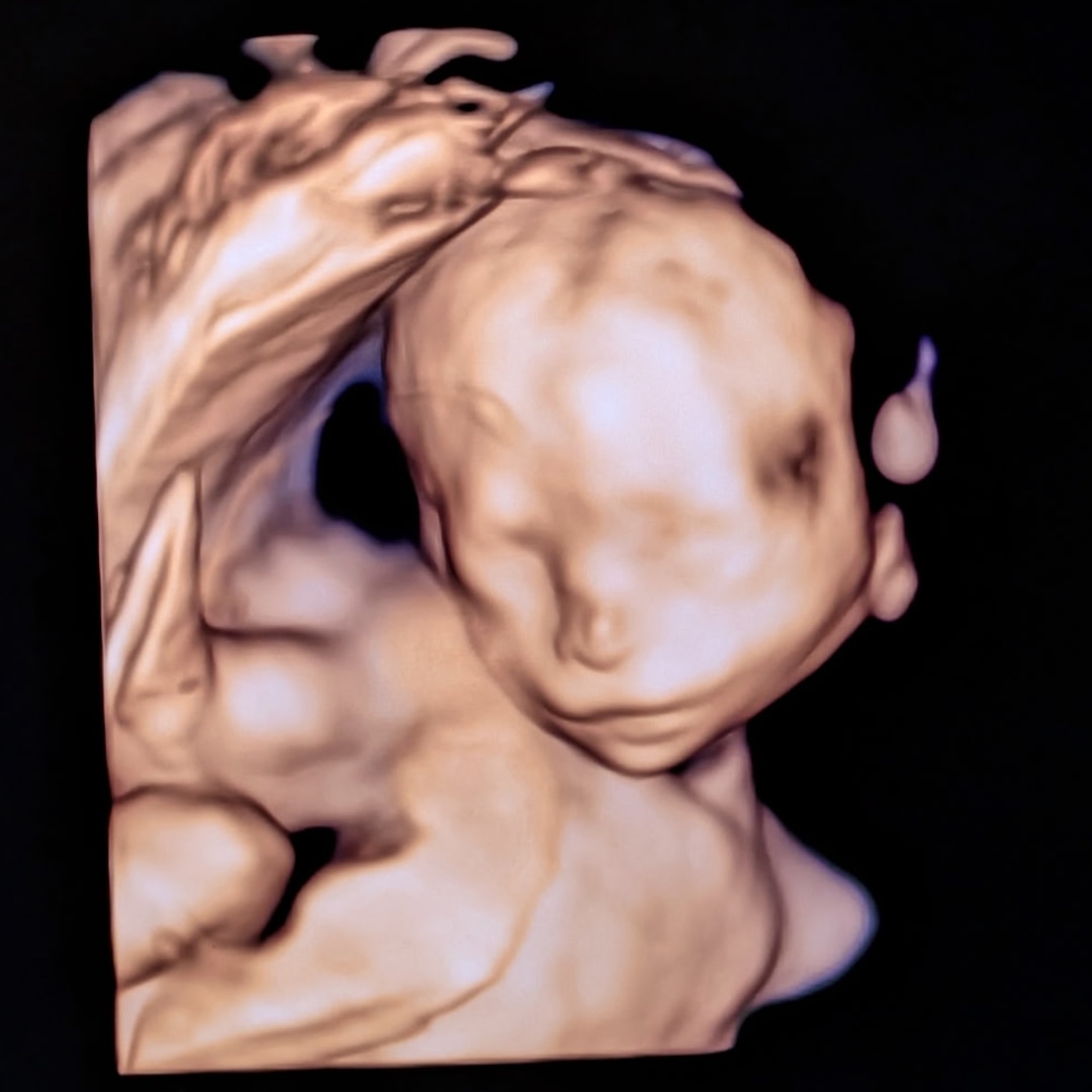 Photo shared by Kelli for their Babylist baby registry.