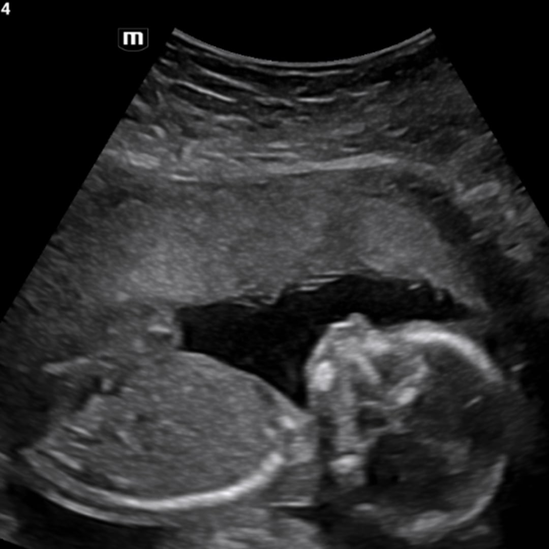 Photo shared by Carley for their Babylist baby registry.