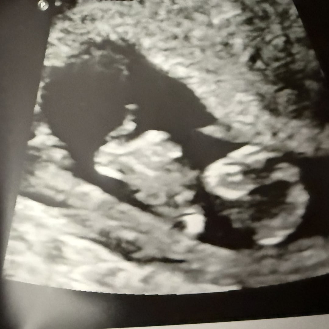 Photo shared by Ashley and Bryce for their Babylist baby registry.