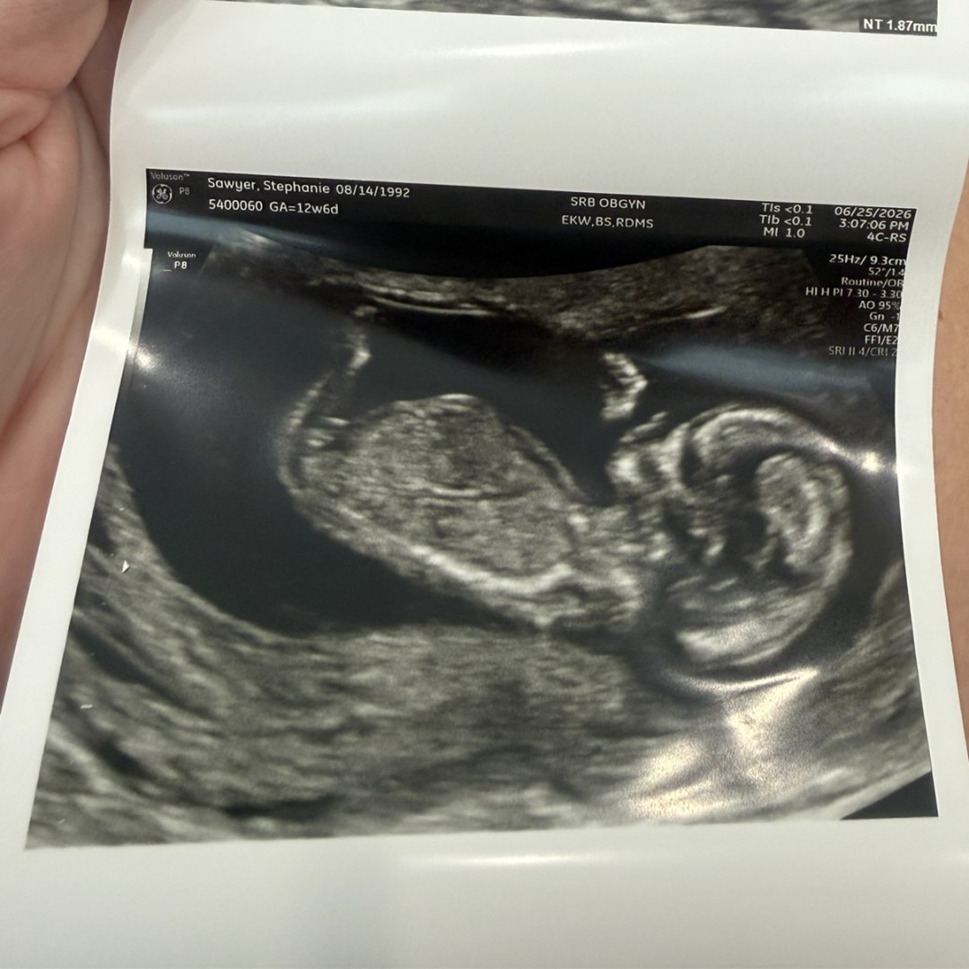 Photo shared by Stephanie for their Babylist baby registry.