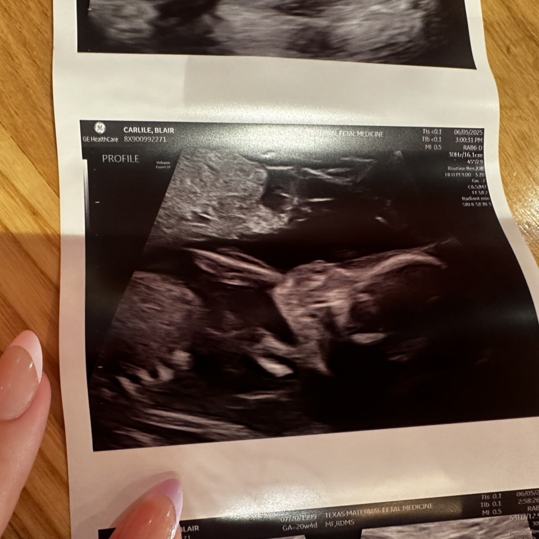 Photo shared by Blair for their Babylist baby registry.