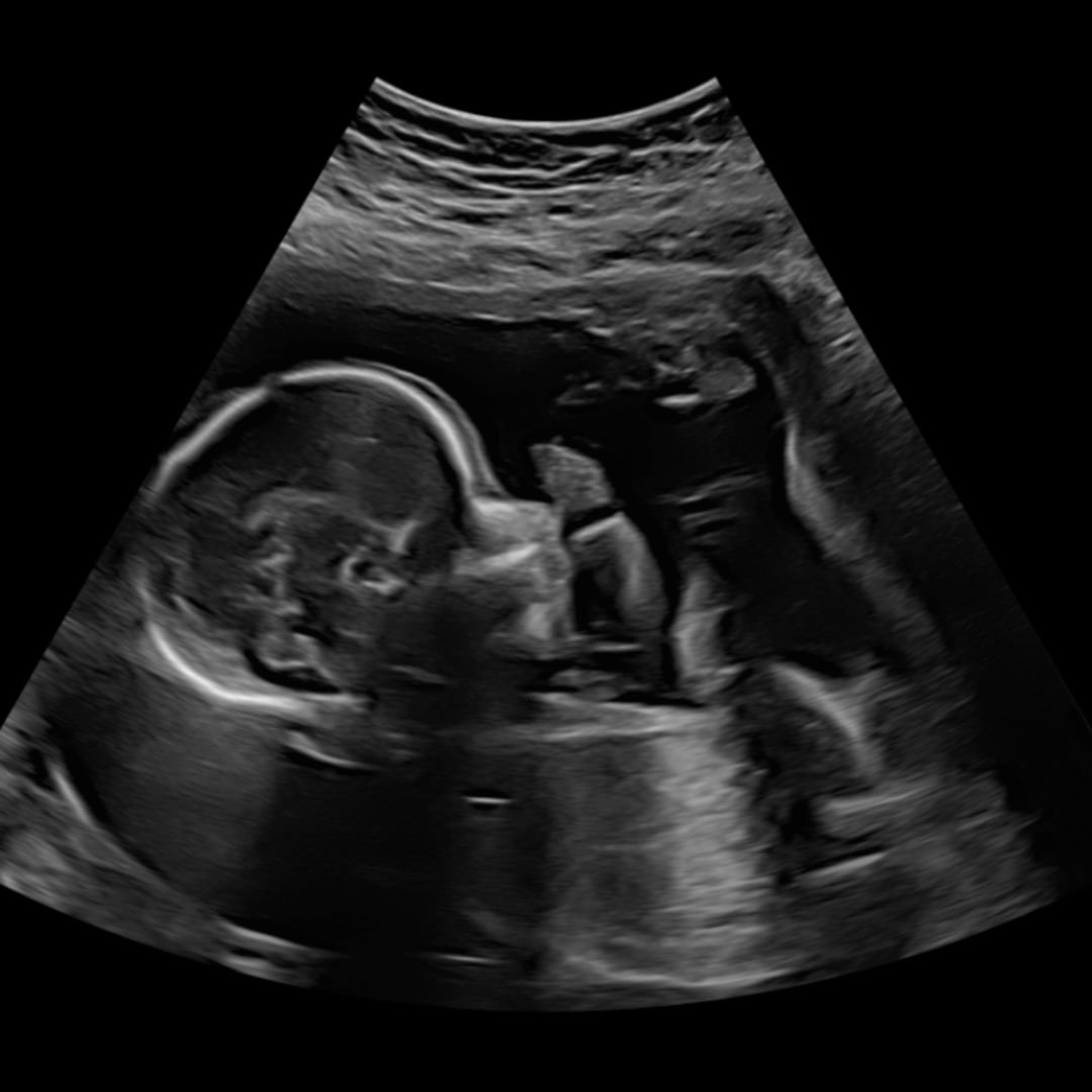 Photo shared by Hannah for their Babylist baby registry.