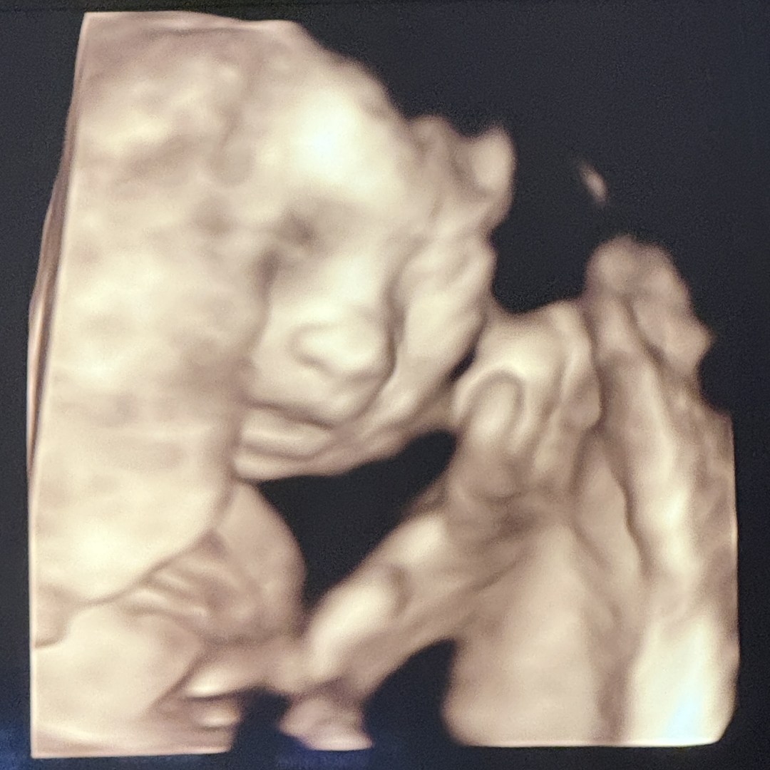 Photo shared by Tabitha for their Babylist baby registry.