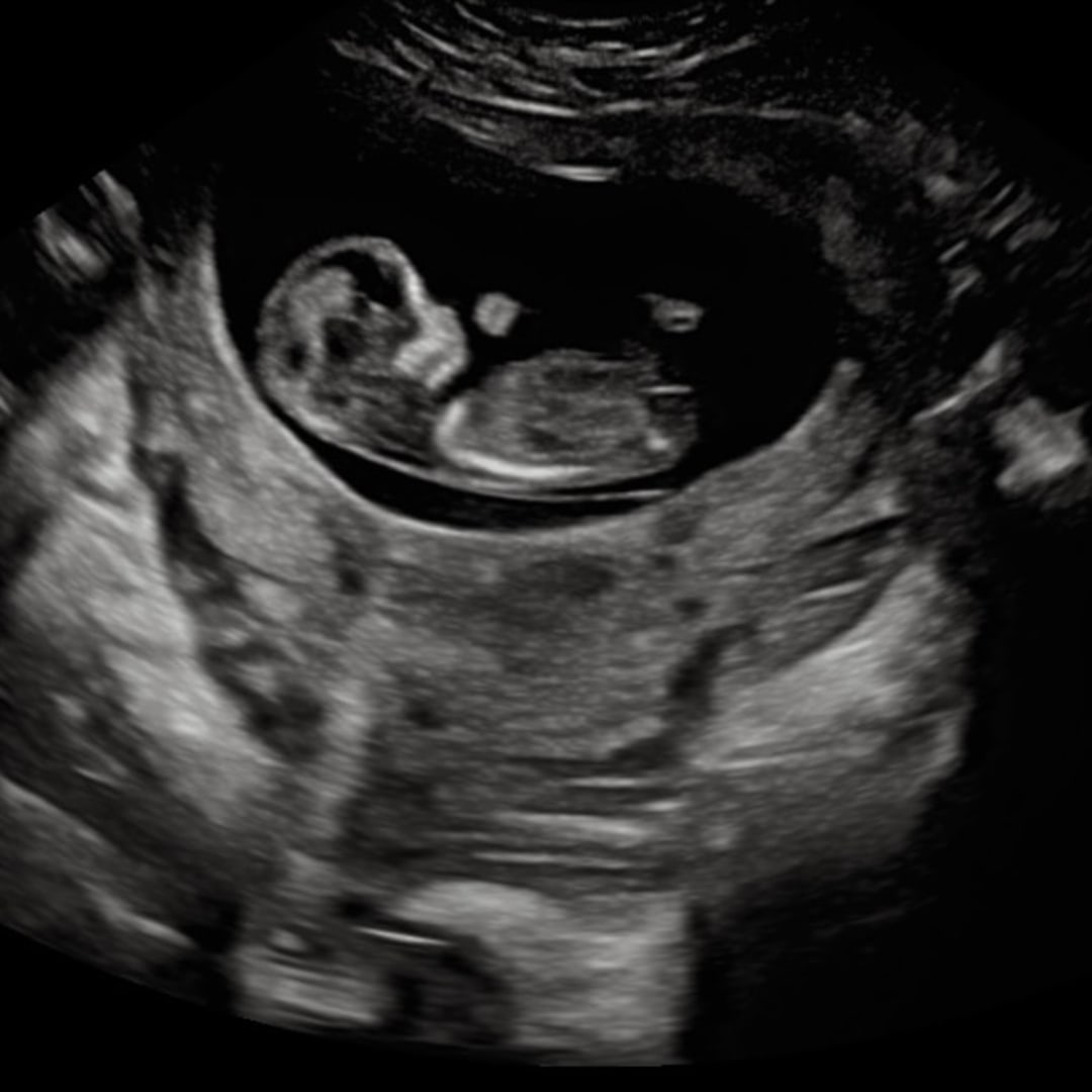 Photo shared by Sara for their Babylist baby registry.