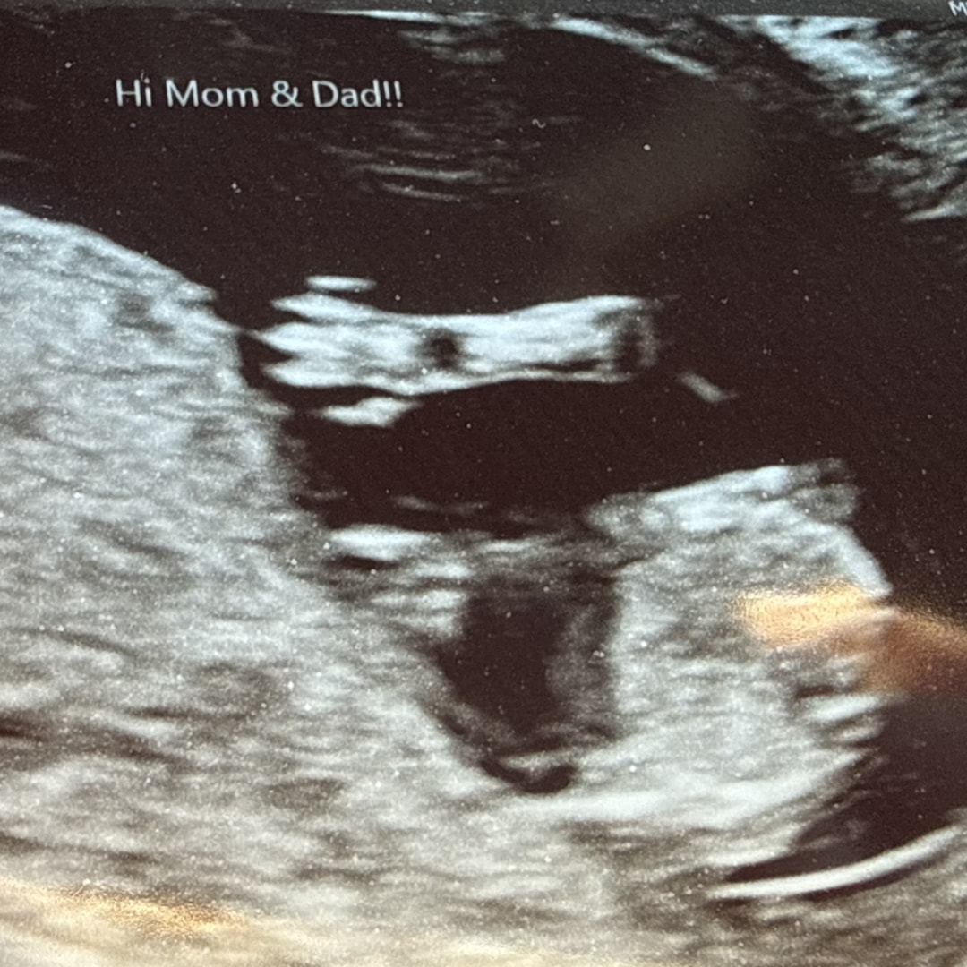 Photo shared by Rebecca for their Babylist baby registry.