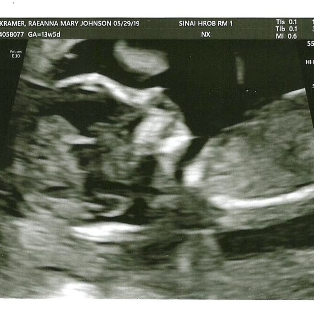 Photo shared by Raeanna for their Babylist baby registry.