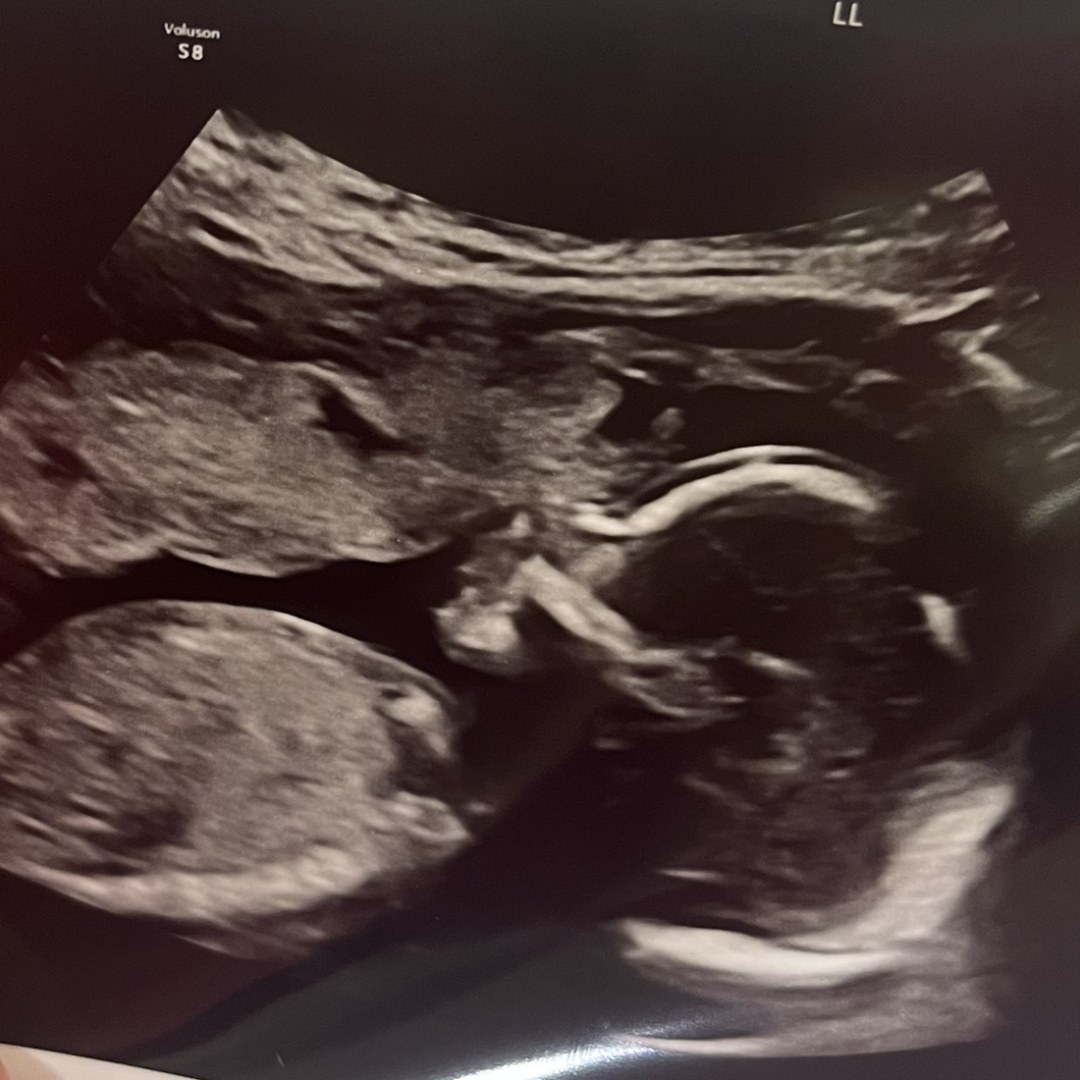 Photo shared by Haley for their Babylist baby registry.