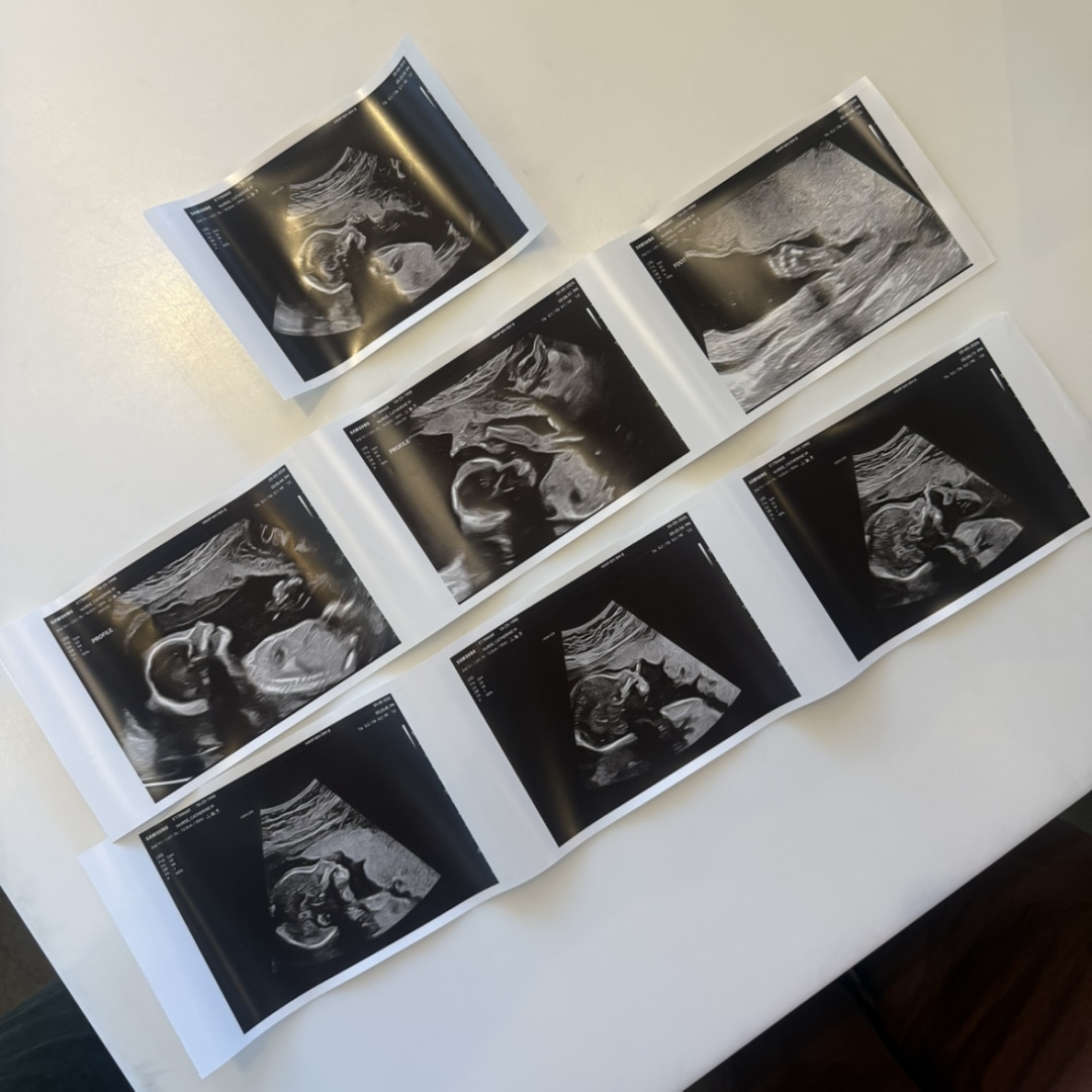 Photo shared by Catherine for their Babylist baby registry.