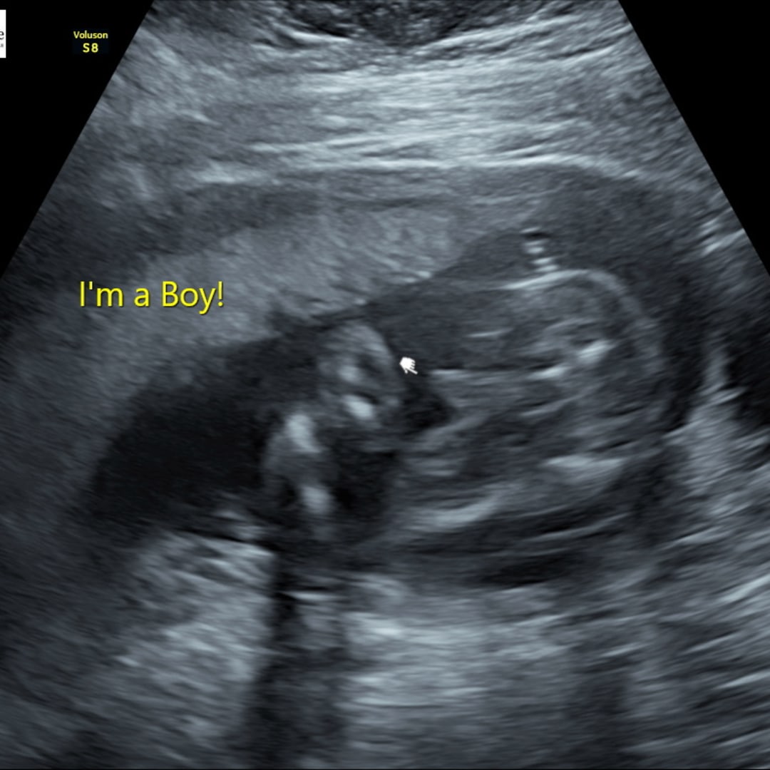 Photo shared by Hanna for their Babylist baby registry.