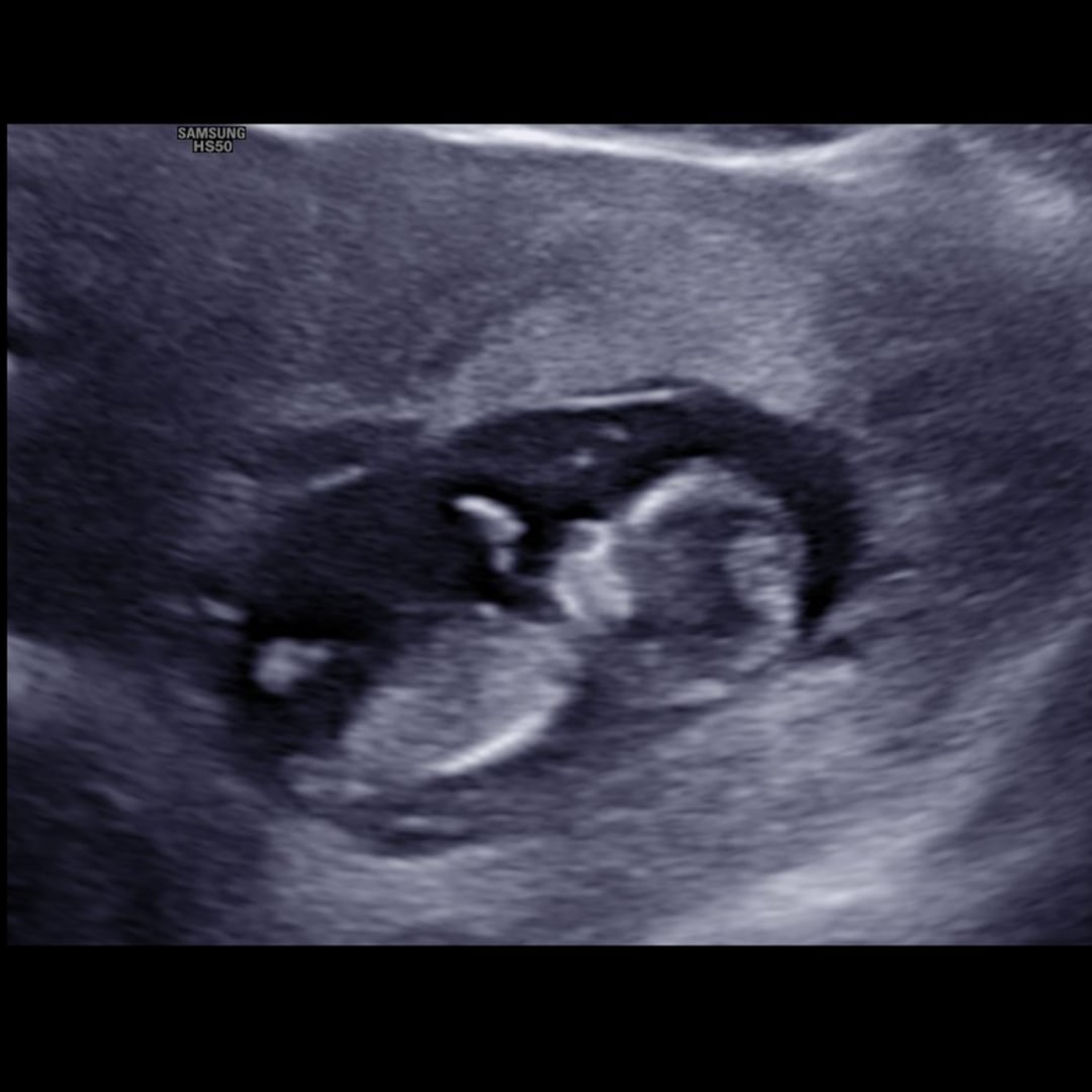 Photo shared by Claire for their Babylist baby registry.