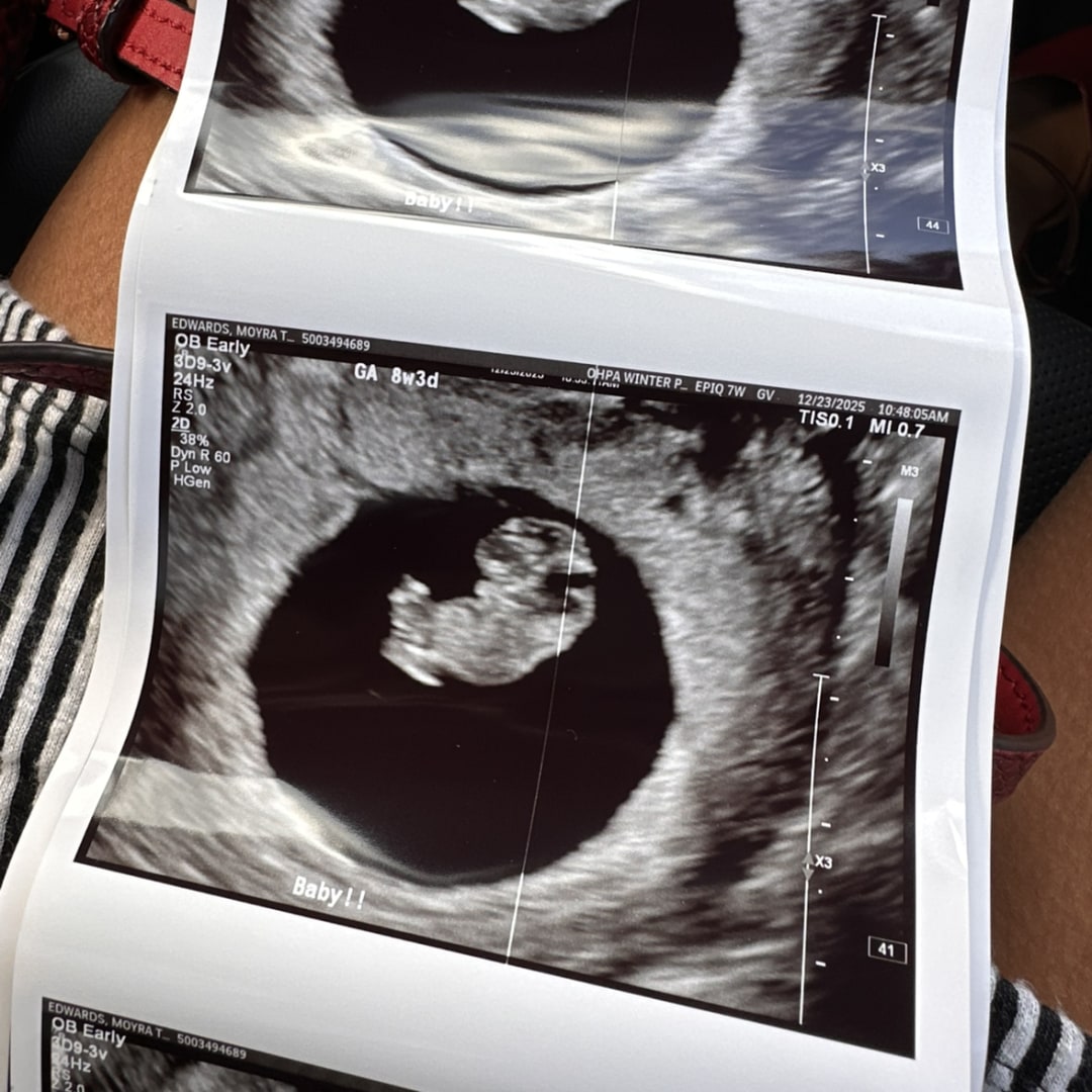 Photo shared by Moyra for their Babylist baby registry.