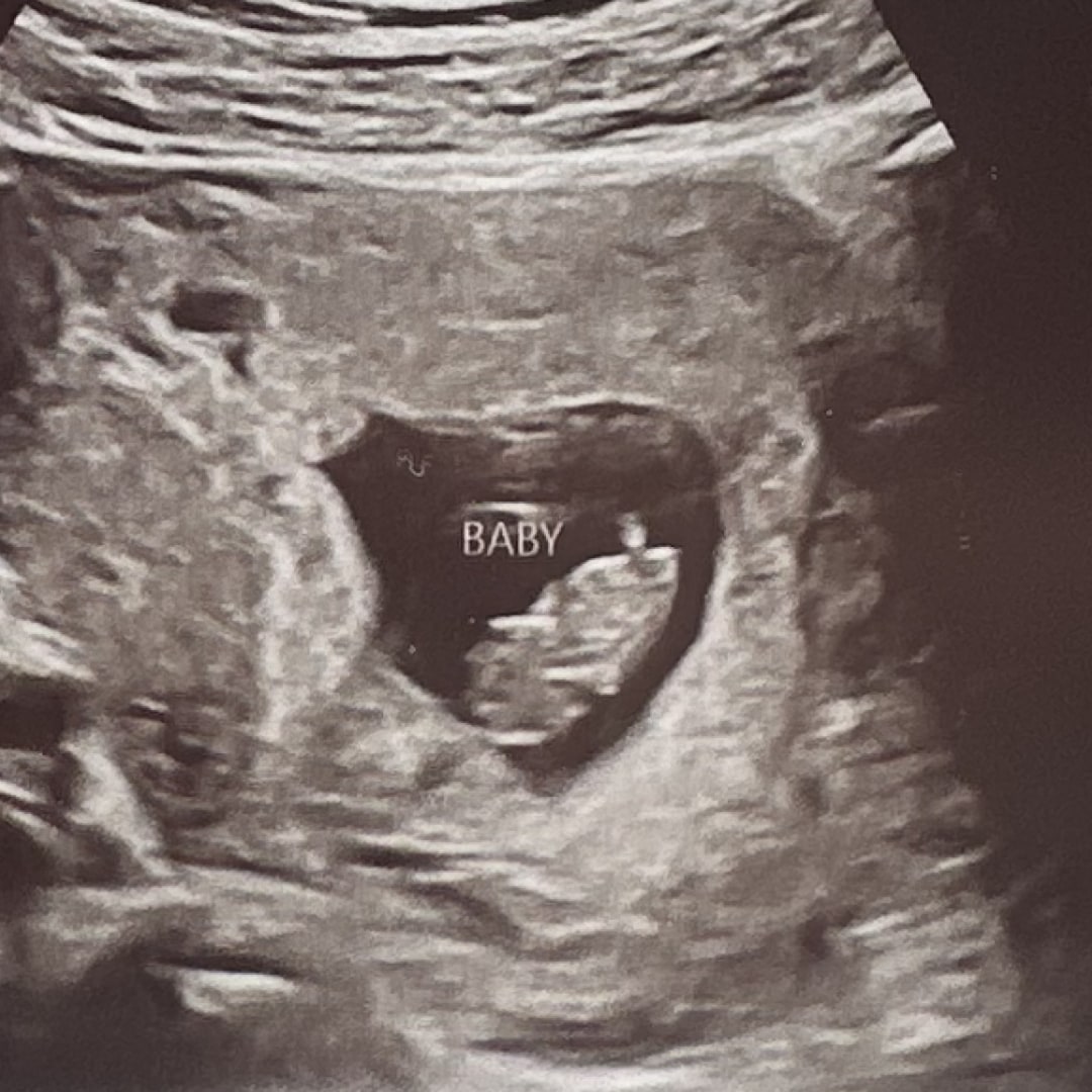 Photo shared by Melanie for their Babylist baby registry.