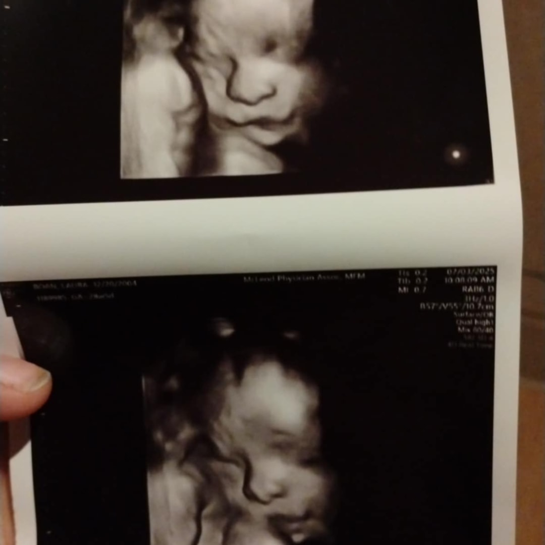 Photo shared by Laura for their Babylist baby registry.