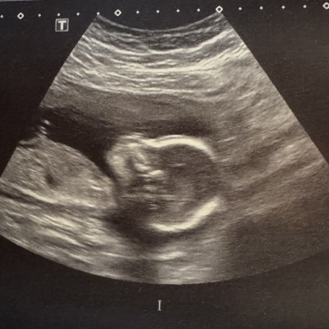 Photo shared by Courtney for their Babylist baby registry.